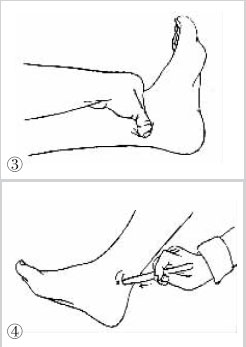 按摩认准“特效保健穴”