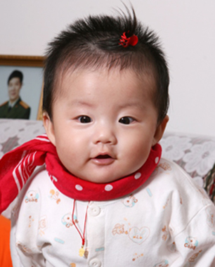 婴幼儿常见中耳炎(图)